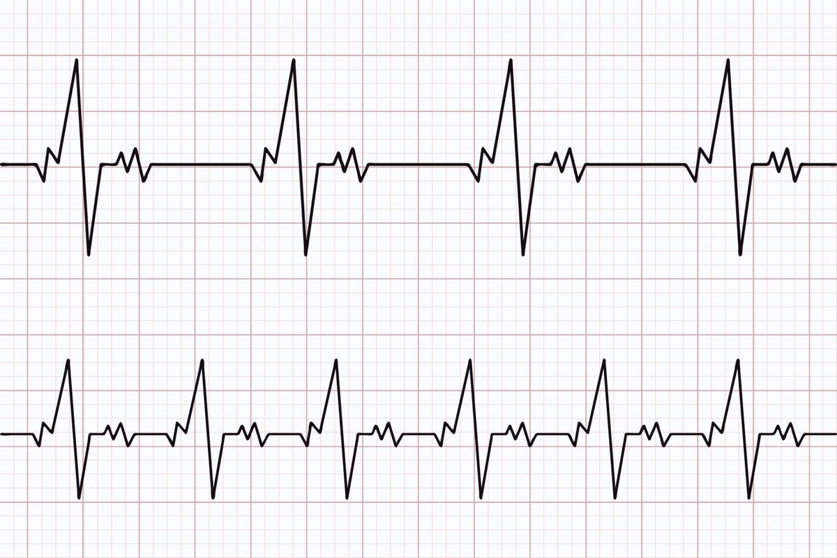 Cardiovascular diseases: The ticking time bomb